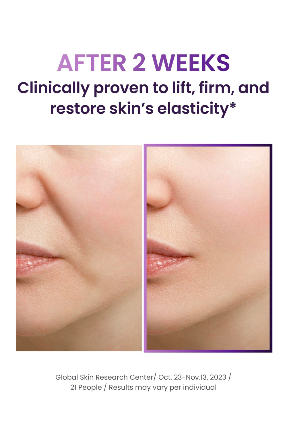 Closeup of Probioderm lifting texture for smooth layering