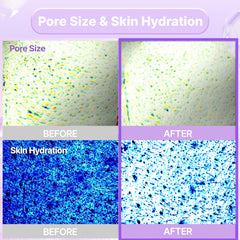 BIOHEAL BOH Probioderm collagen capsules inside mask suggesting subtle plumping effect