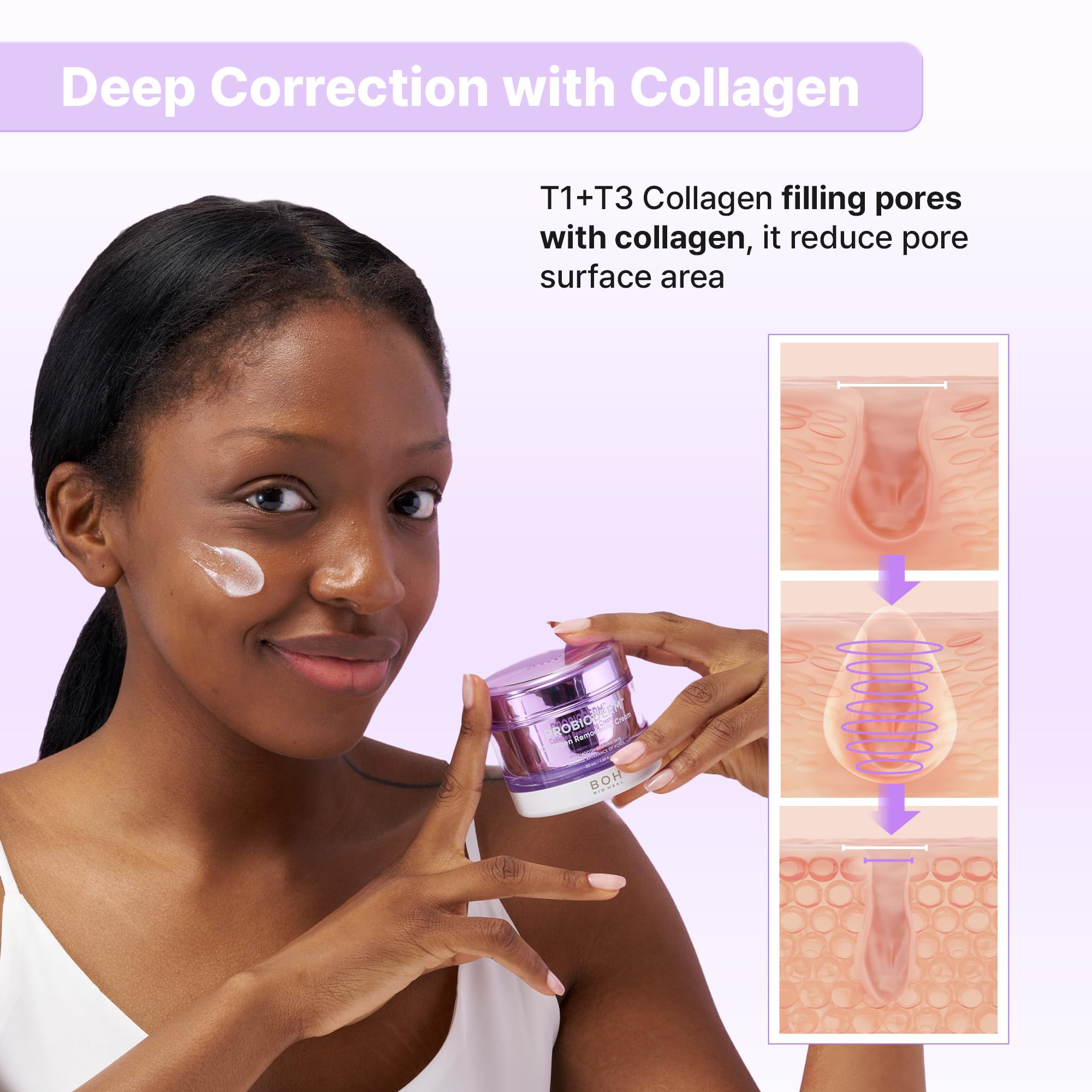 BIOHEAL BOH Probioderm pore refinement graphic illustrating smoother pores