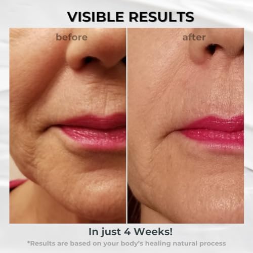 BIONOVA packaging shows ingredients like hyaluronic acid for hydration.