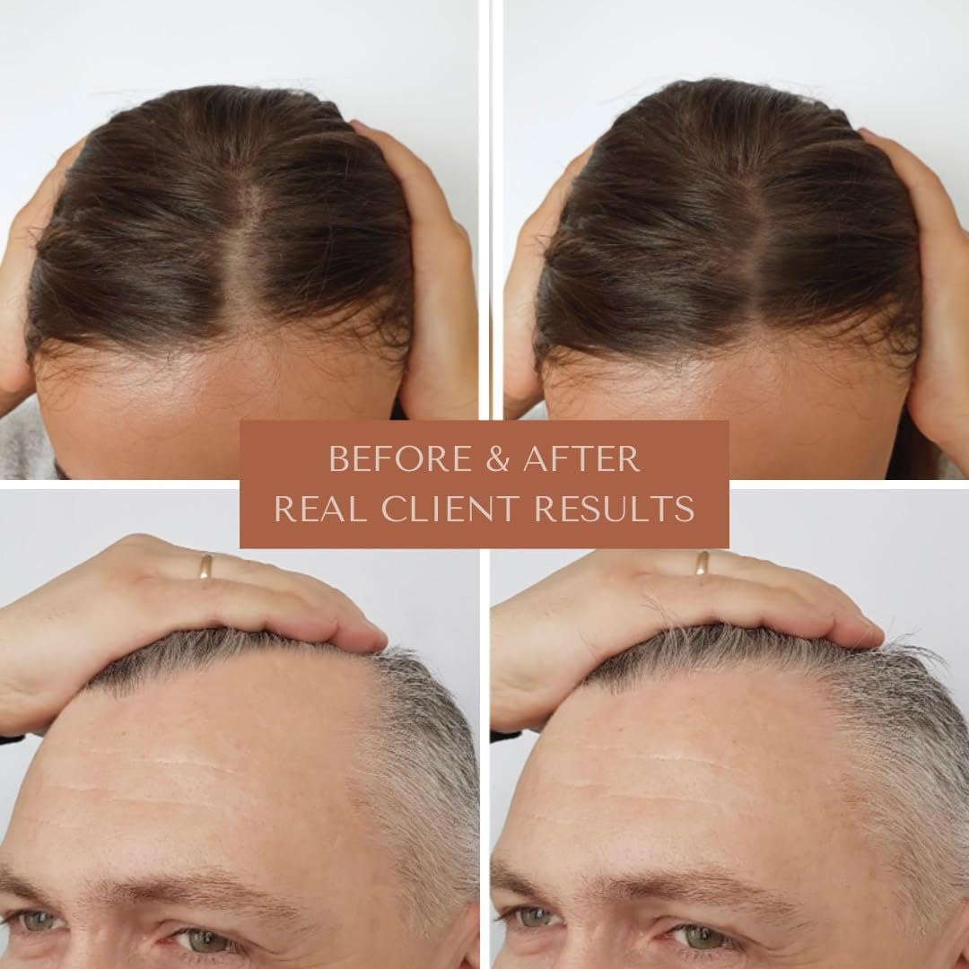Bioregen Co Rapid Hair Growth Oil application demonstrated with hands massaging the scalp.