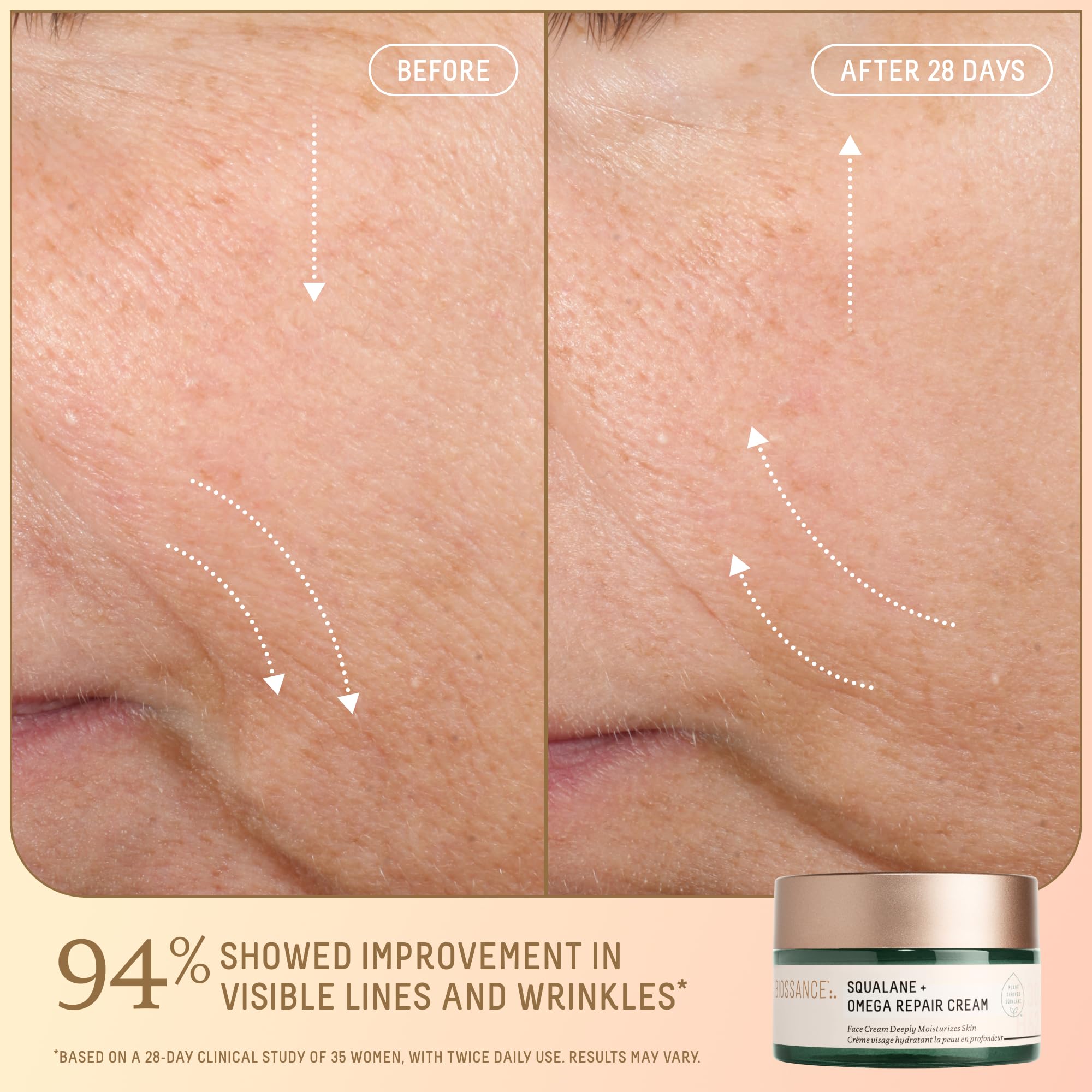 BIOSSANCE Rose Oil dropper close-up showing precise application