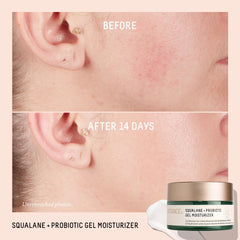 Biossance Squalane + Probiotic Gel Moisturizer packaging front with clean design.