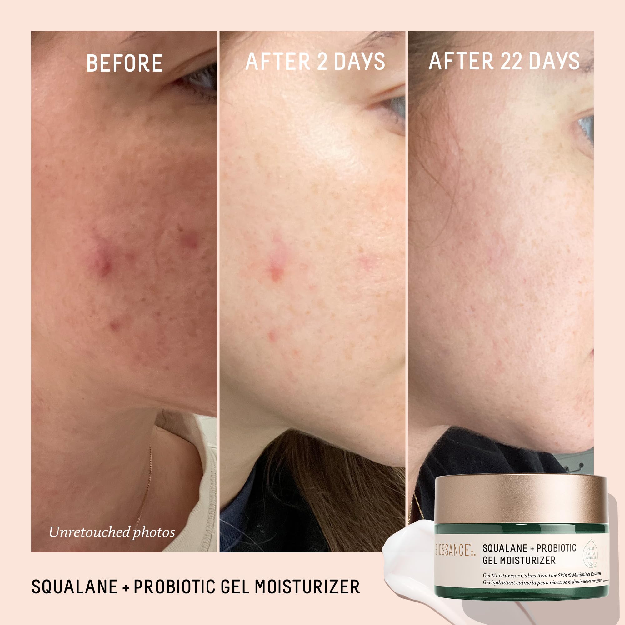 Biossance Squalane + Probiotic Gel Moisturizer texture close-up with lightweight feel.