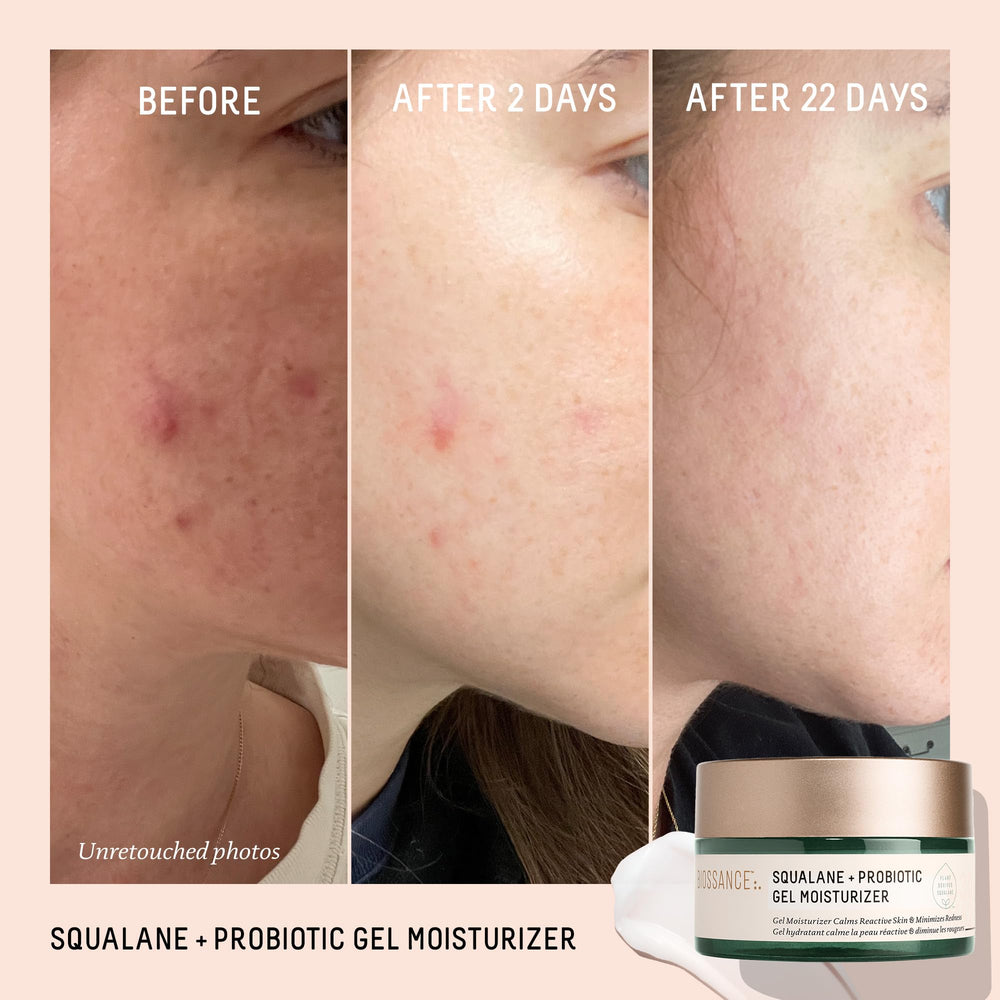 Biossance Squalane + Probiotic Gel Moisturizer texture close-up with lightweight feel.