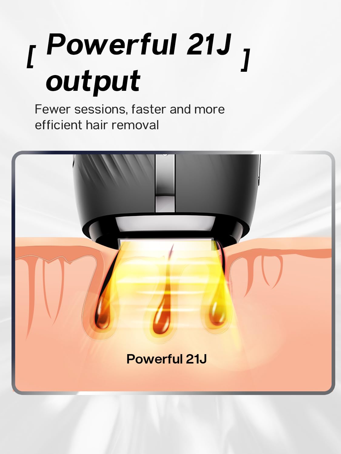 Blex device energy emphasis 21J over 3cm² shows targeted follicle approach.