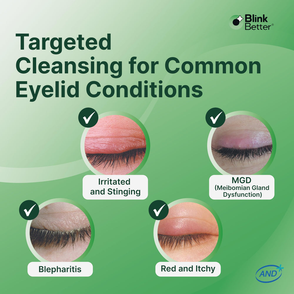 BlinkBetter BetterLids micellar action lifting dirt and oil gently.