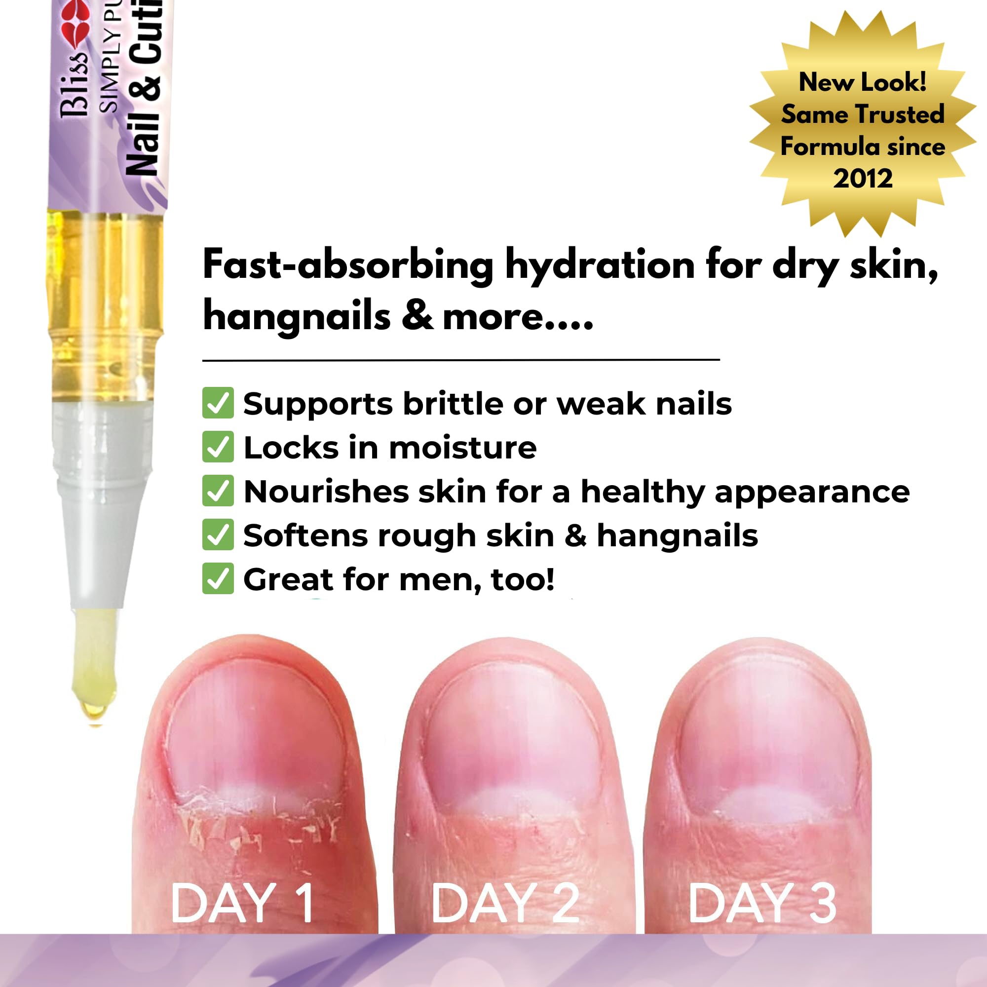 Hydrated cuticles around neat, well-groomed nails.