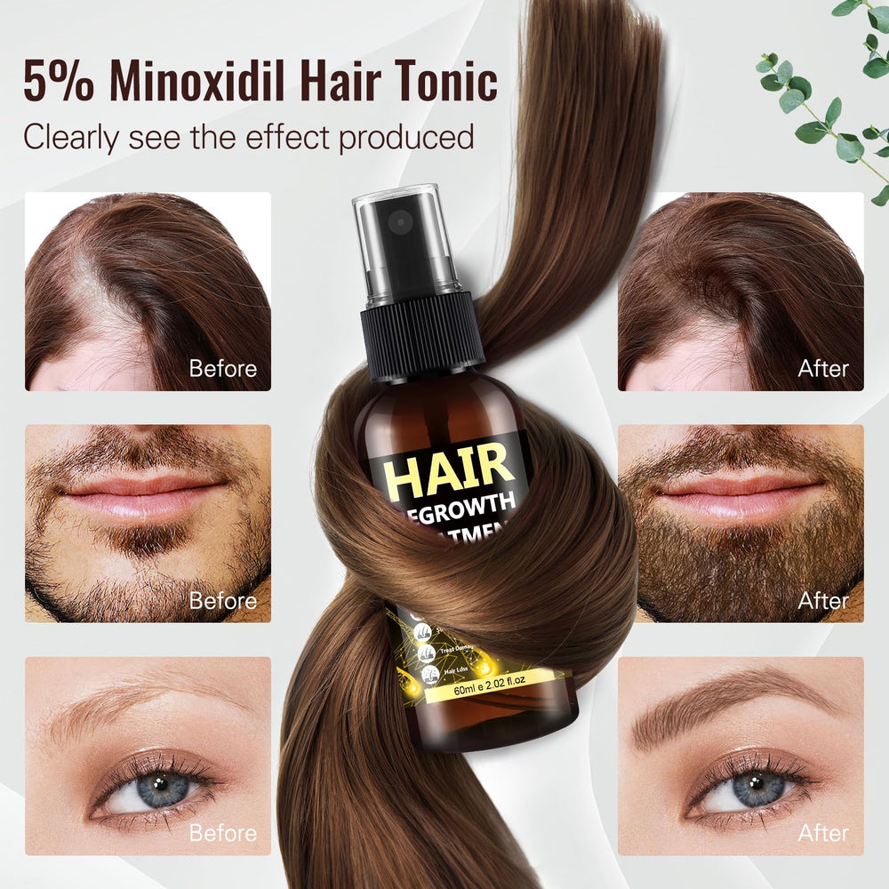BLISSMATE minoxidil spray packaging highlighting easy to use bottle