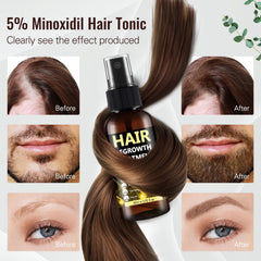BLISSMATE minoxidil spray packaging highlighting easy to use bottle