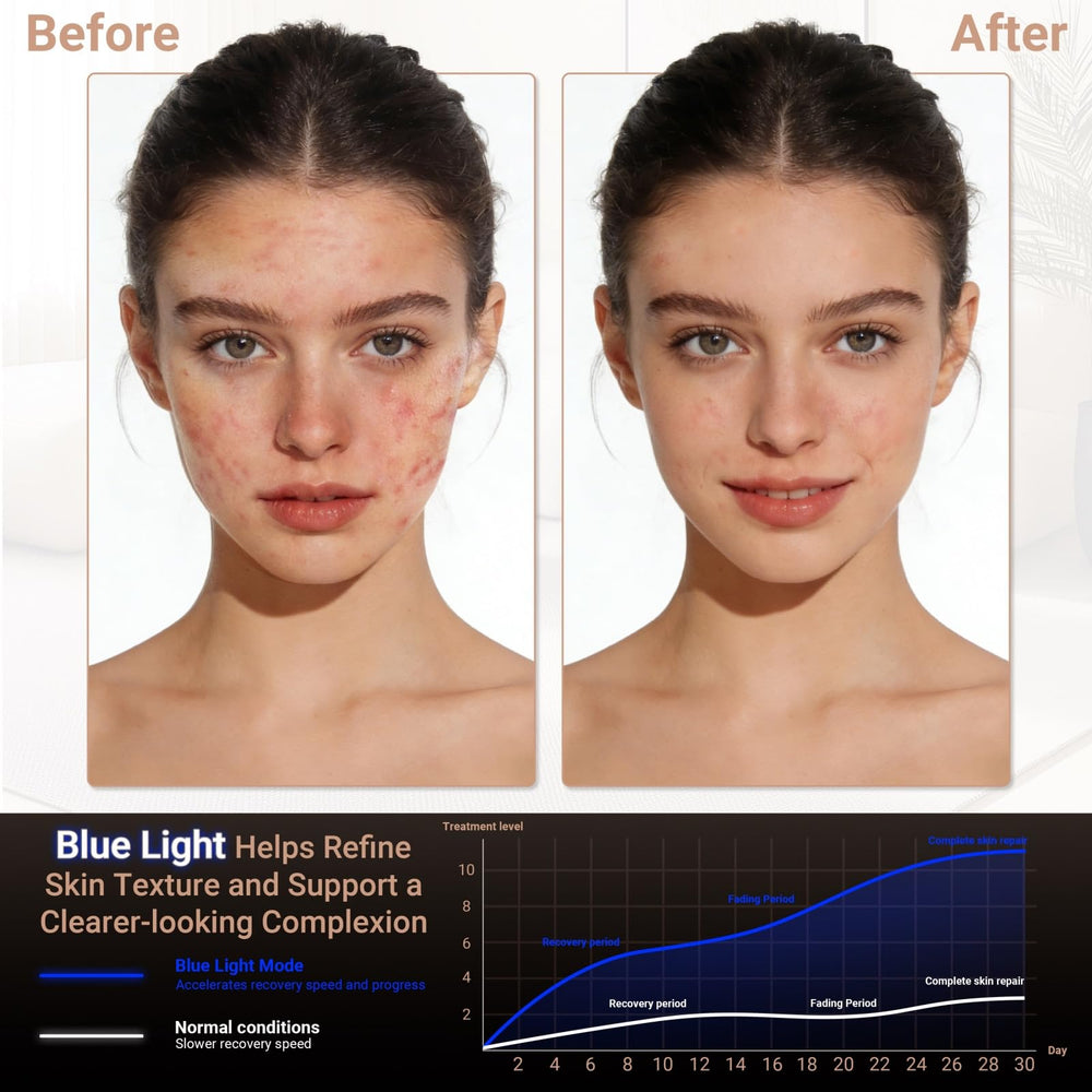 BLISSMON eye-protection feature demonstrates shielded eye area for comfortable use