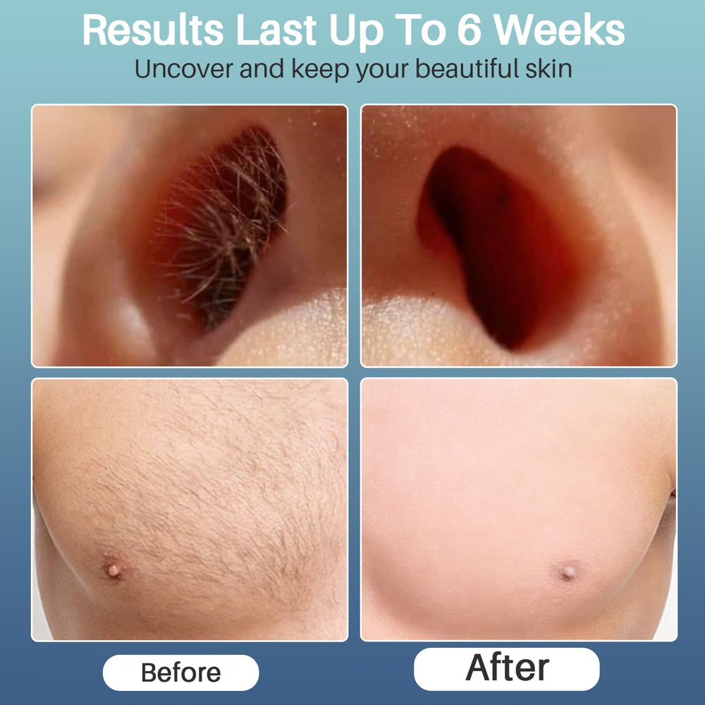 BLITZWAX strong-hair-adhesion formula for efficient hair removal