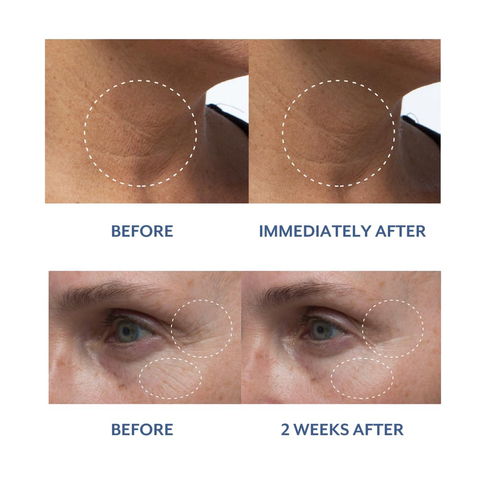 Sleep-night usage of Bloomeffects Royal Tulip Nectar as a nourishing overnight mask