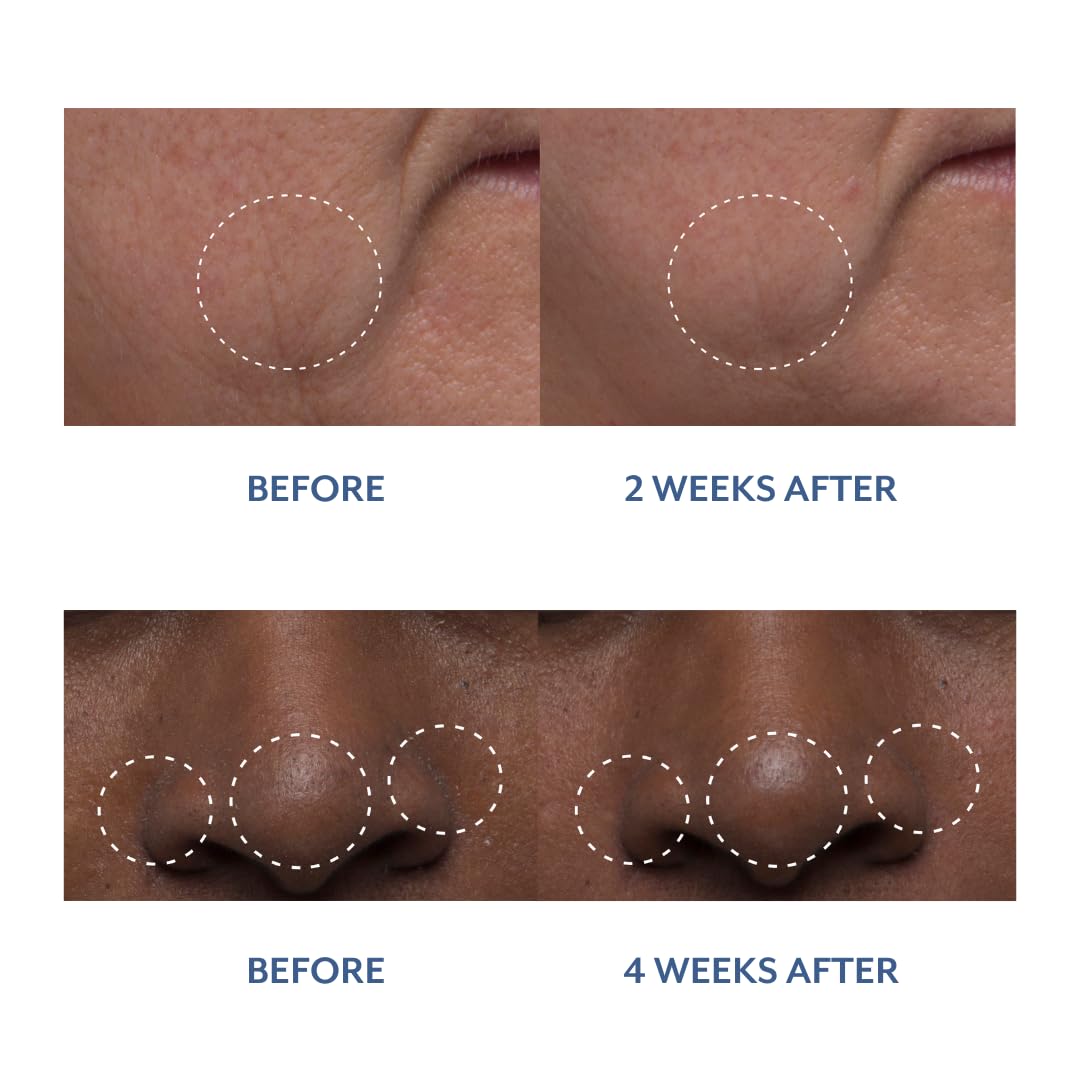 Bloomeffects Tulip Dew Drops droplet being dispensed indicates easy, precise application