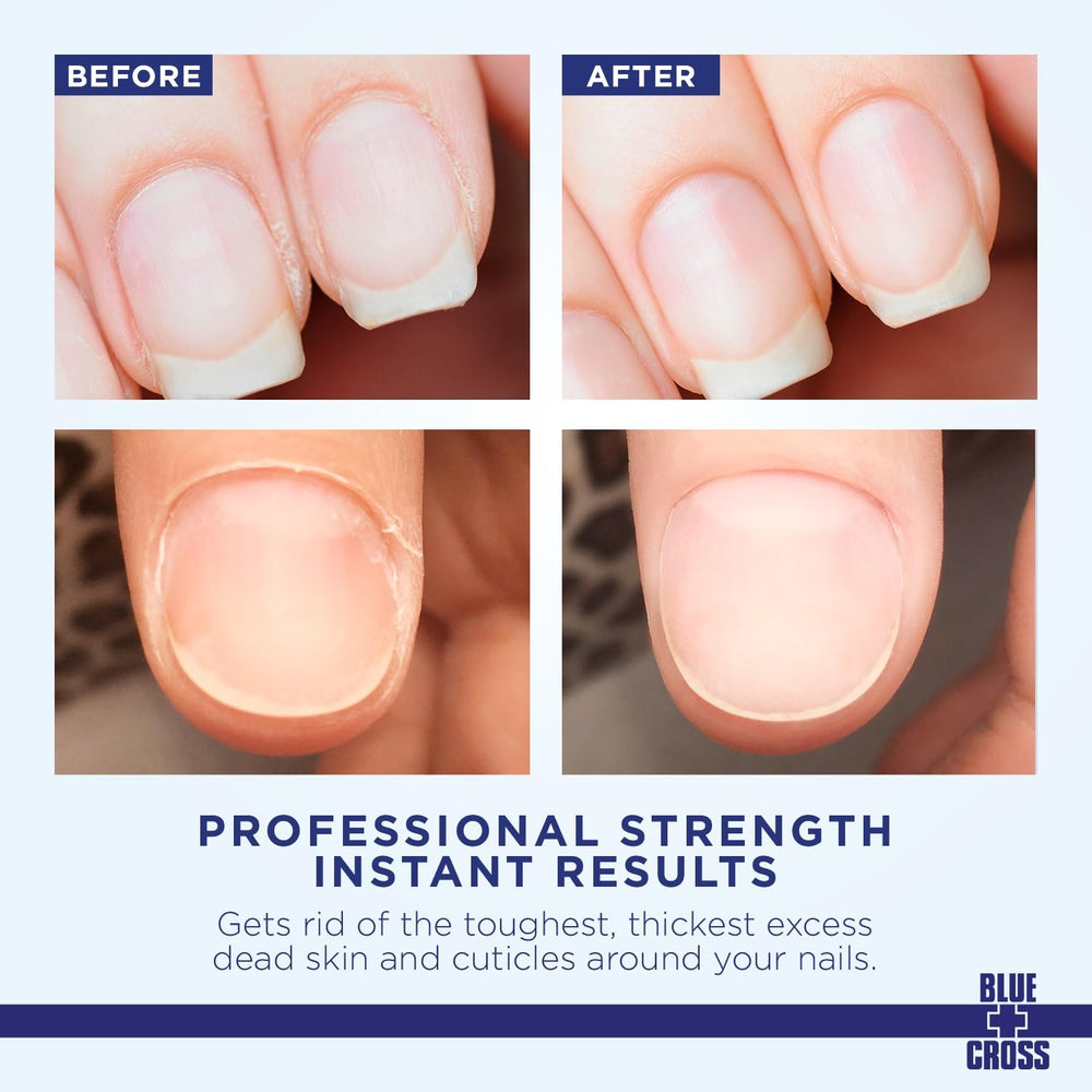 Blue Cross Cuticle Remover liquid drops applied around nails for quick softening.