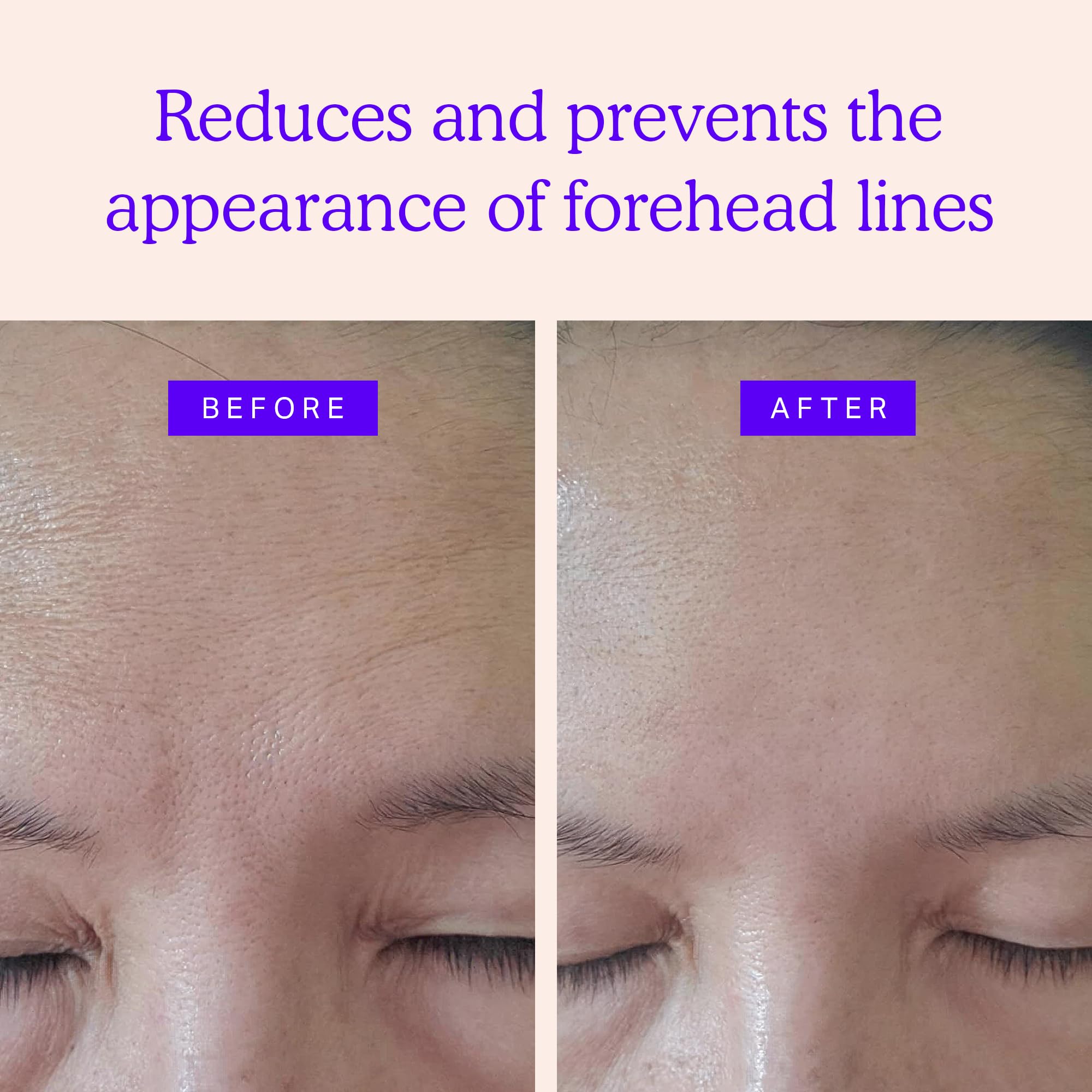 BLUMBODY patch application on forehead shows discreet, non-intrusive use