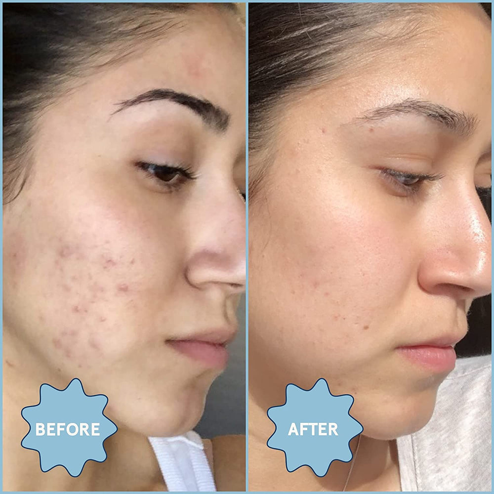 Blume Meltdown hydration glow image suggests a balanced, non-drying feel during routine.