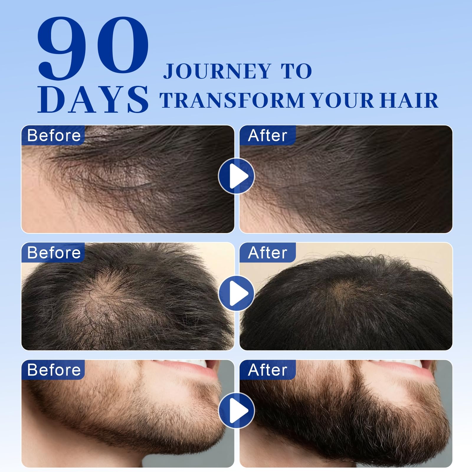 BLUPROTIN bottle highlights fuller-looking hair with gentle, spa-like care.