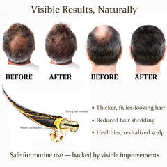 Boaccy Biotin-Keratin Boost highlights stronger strands and easier styling