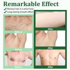 Bocello calming oil wipes for post-wax skin soothing.