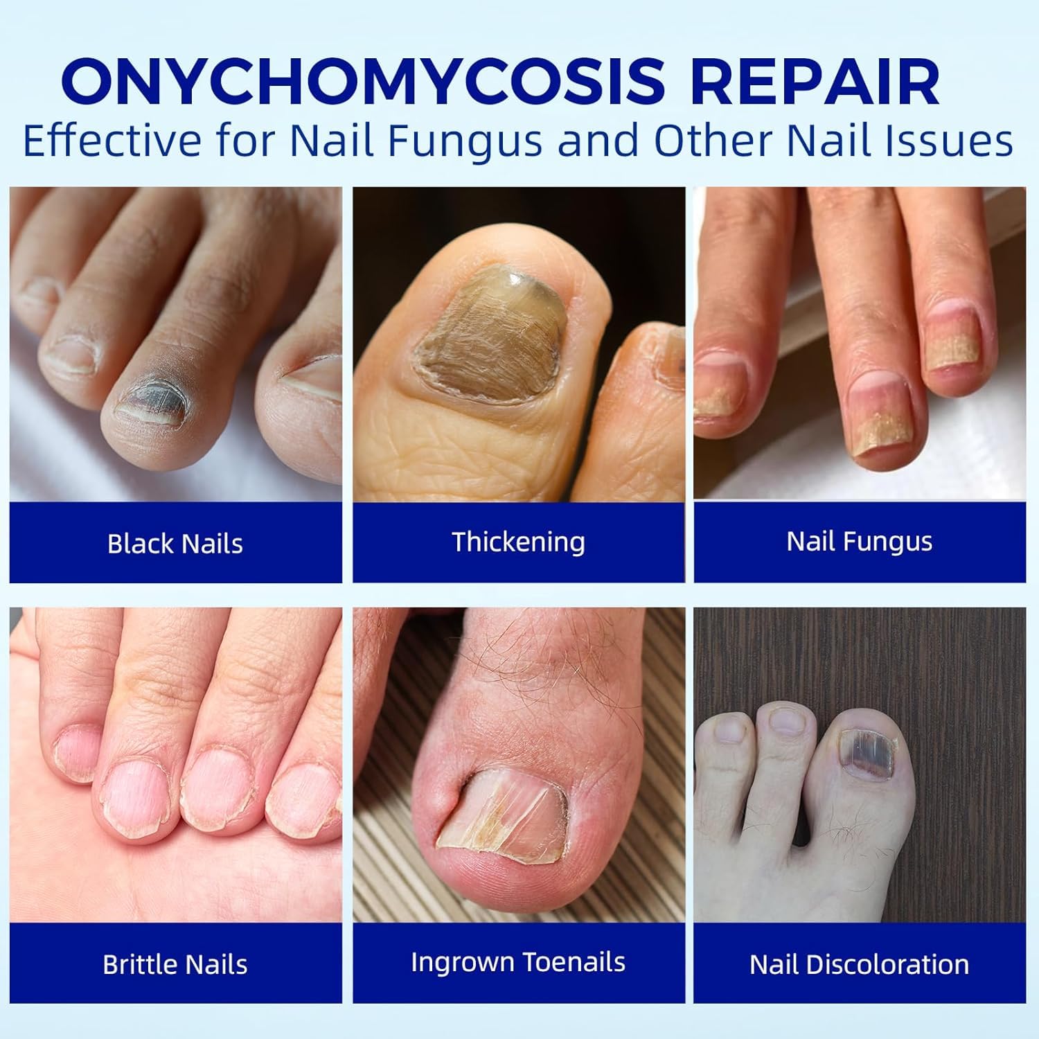 BOELIKAYS nail patches targeting discoloration for a smoother nail appearance.