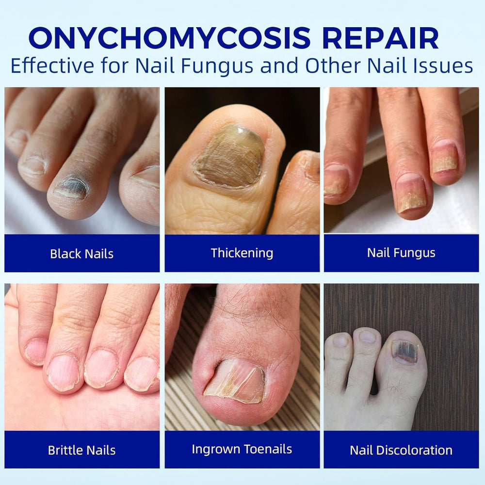 BOELIKAYS nail patches targeting discoloration for a smoother nail appearance.