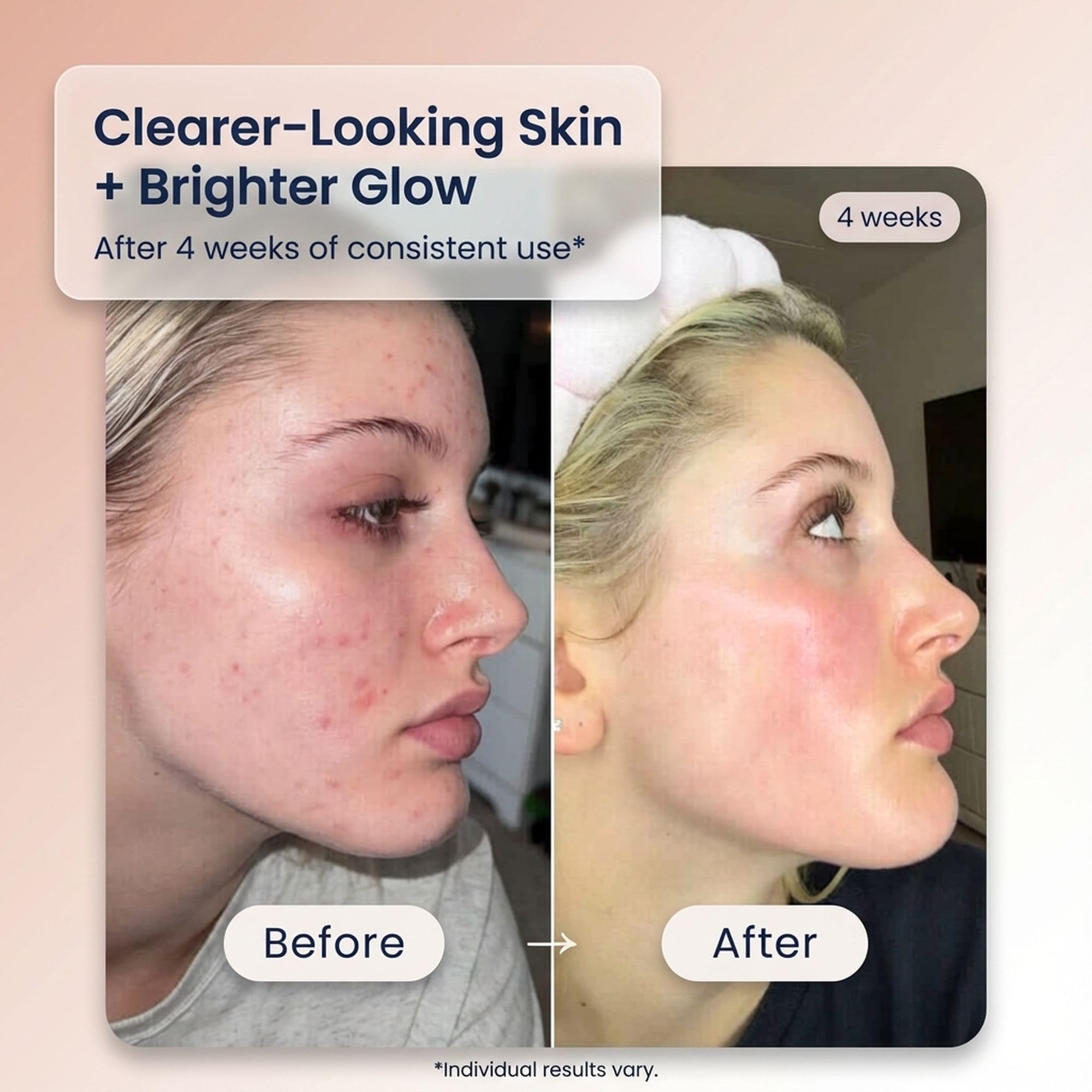 Fragrance-free Kay's Glow Serum formula for sensitive users