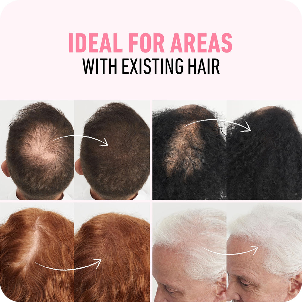 Boldify Hair Fibers crown fill targets thinning at the crown.