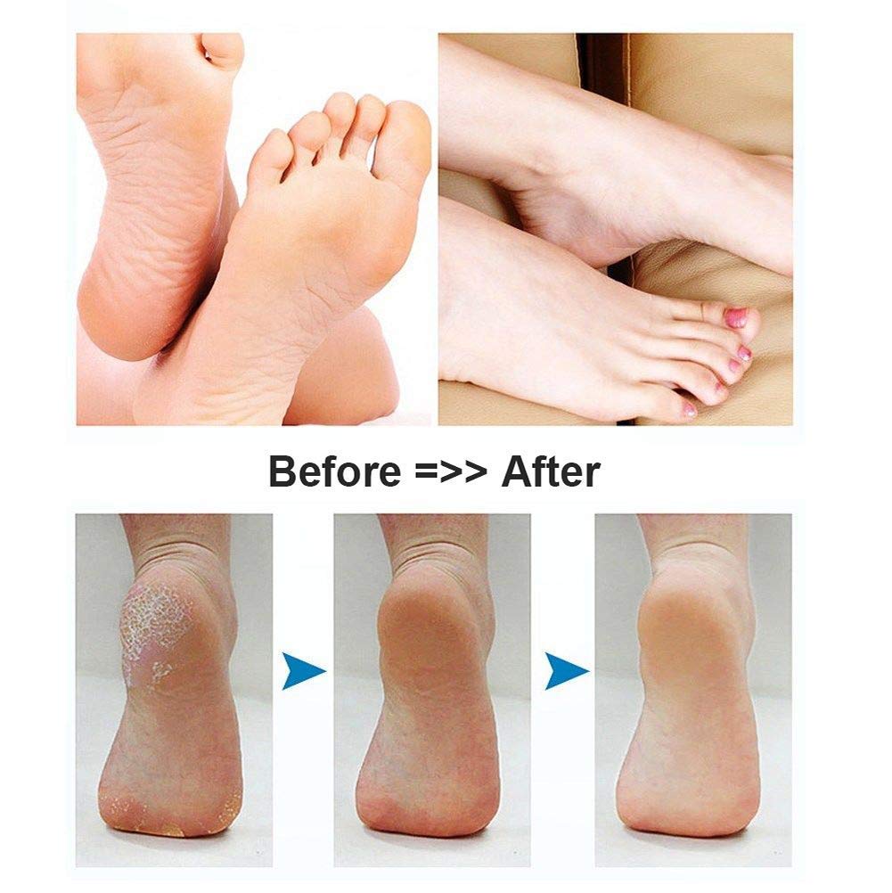 BOMPOW foot scrubber roller heads for soft and hard callus care.