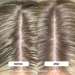 BondiBoost HG Clarifying Rinse bottle and apple cider vinegar label clarifying action.