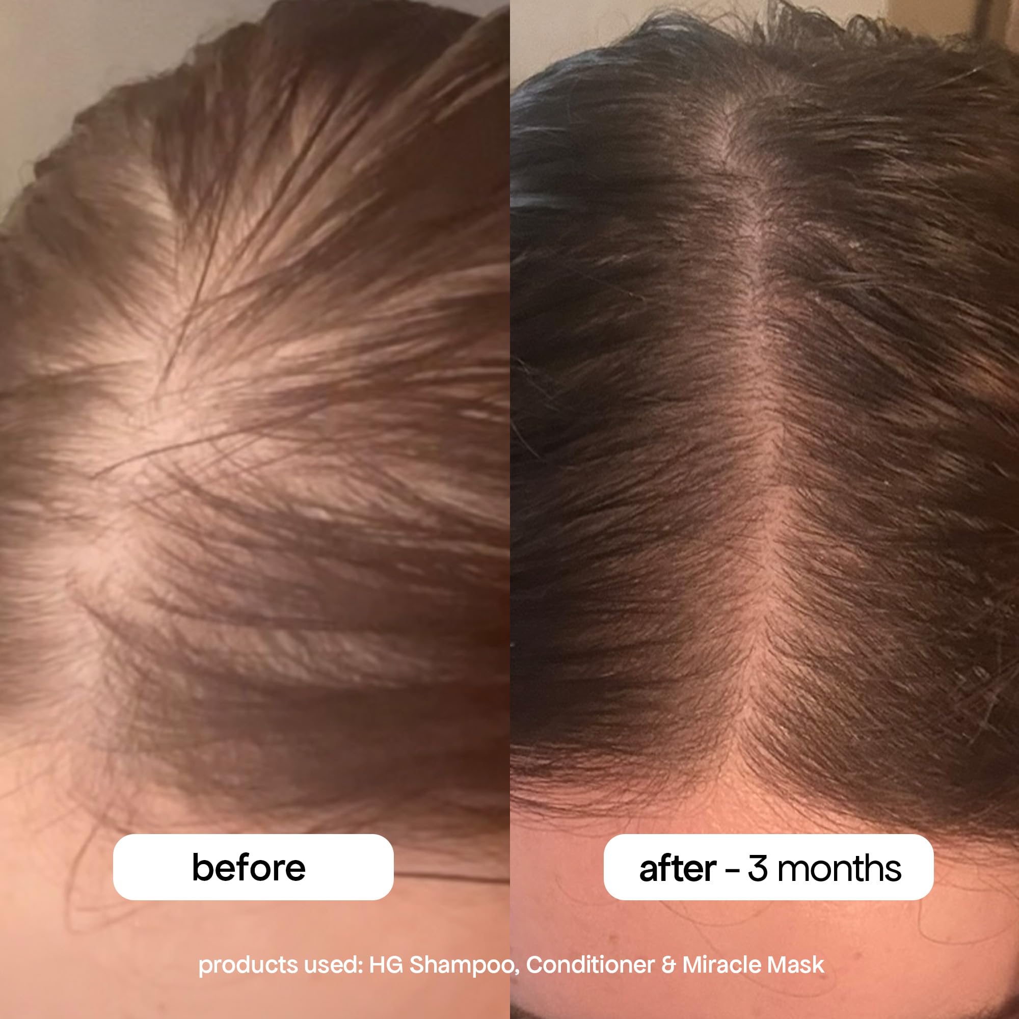 BondiBoost HG ingredient label highlighting Procapil and Redensyl for hair support.
