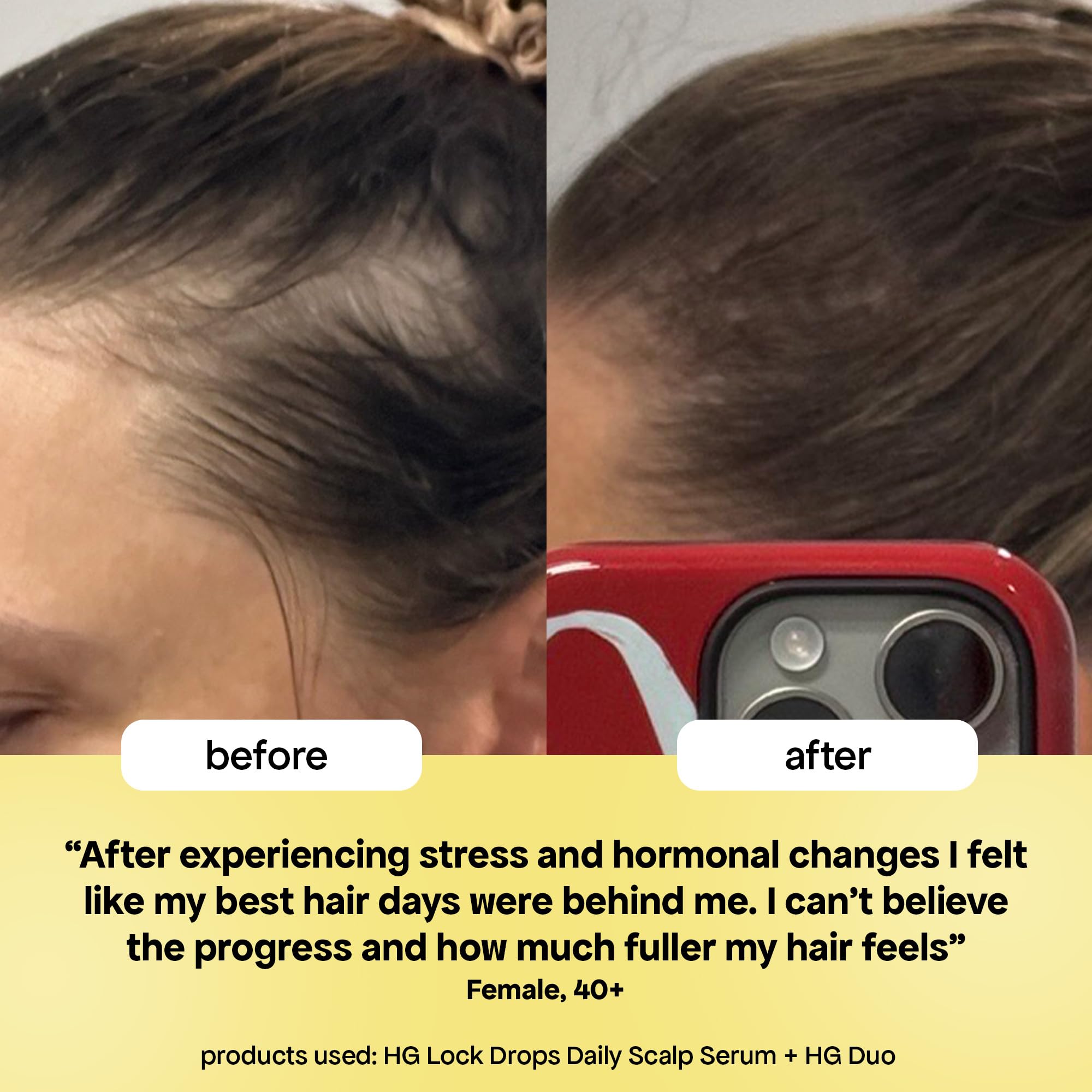 Daily-use BondiBoost HG Lock Drops integrated into routine