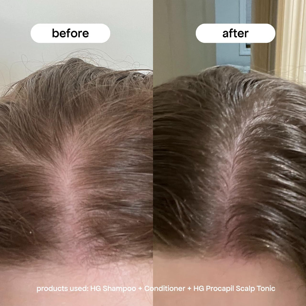 Hands applying Bondiboost Procapil to the scalp during morning routine