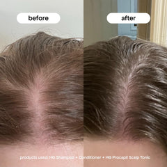 Hands applying Bondiboost Procapil to the scalp during morning routine