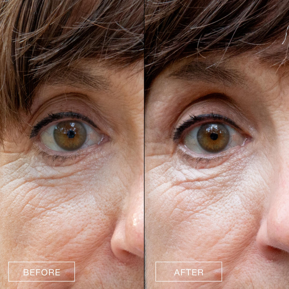 Boom Awaken cooling under eye cream swatch on skin shows lightweight texture.