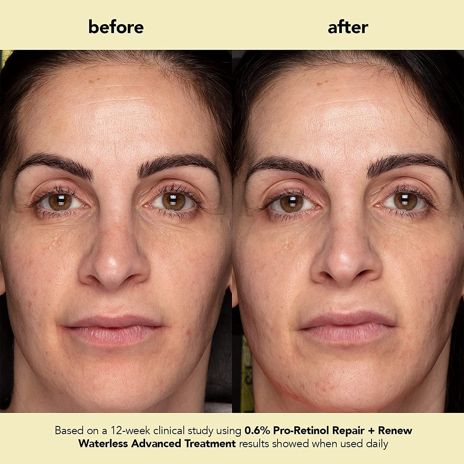 Boscia Plant-based retinol formula icon communicates natural, gentle anti-aging support.