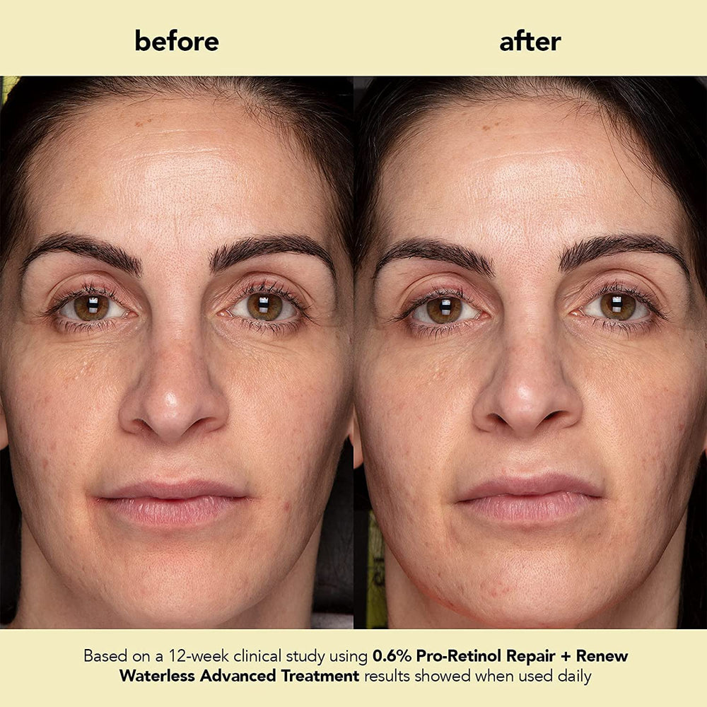 Boscia Plant-based retinol formula icon communicates natural, gentle anti-aging support.