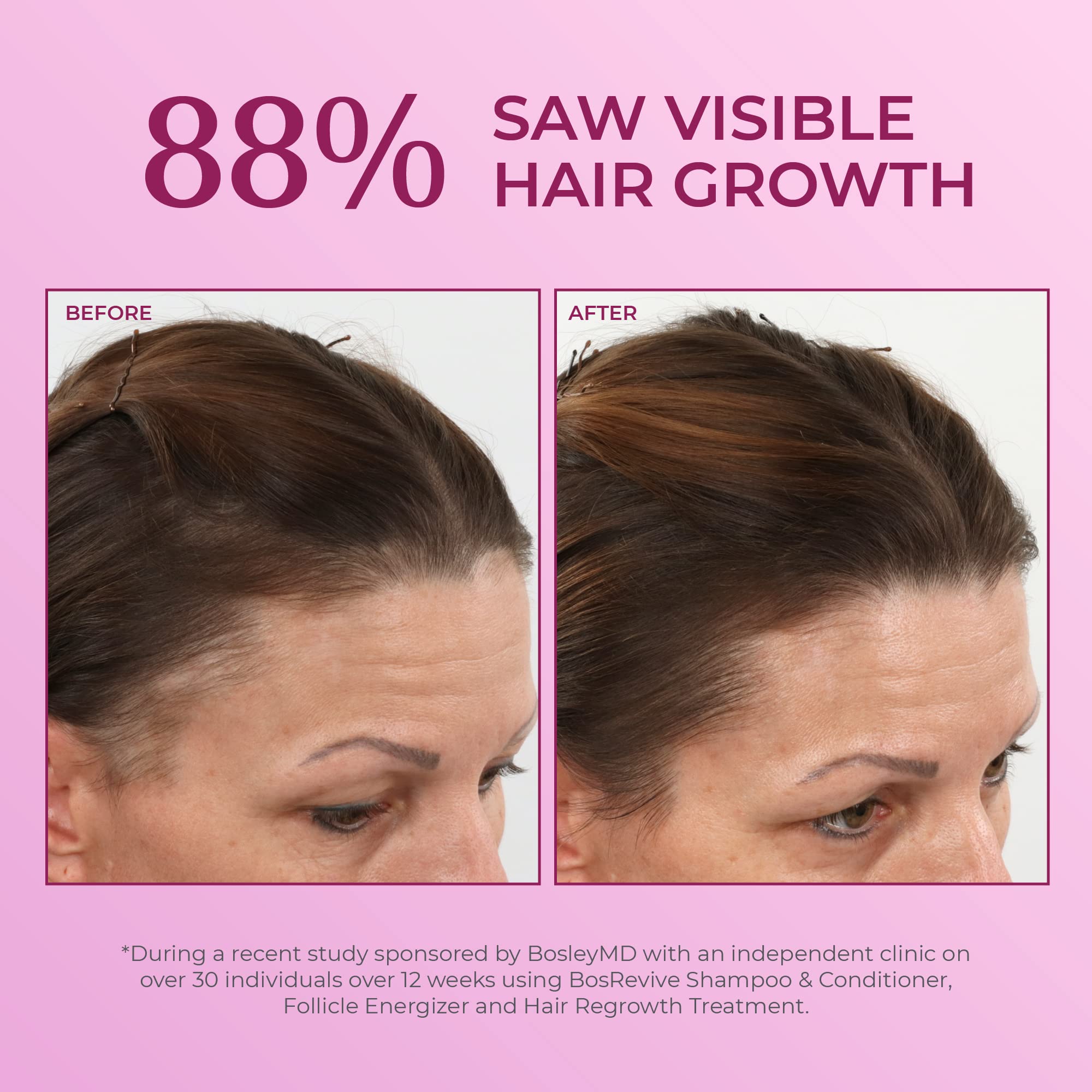 BosleyMD application scene shows simple leave-in routine for daily use.