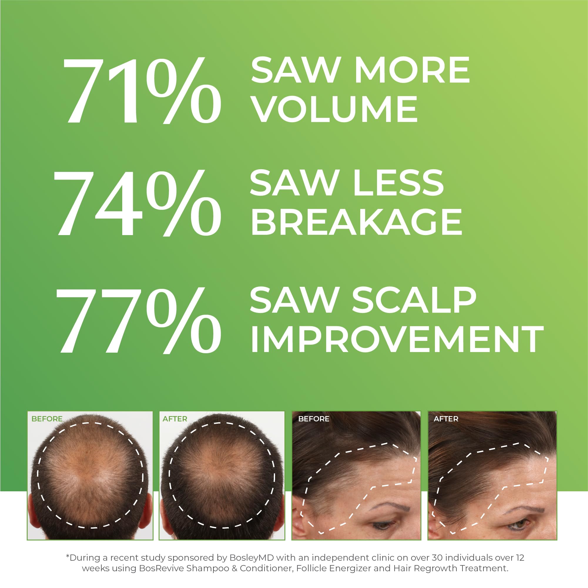 BosleyMD ingredients panel showcases biotin, caffeine, and plant extracts for scalp vitality.