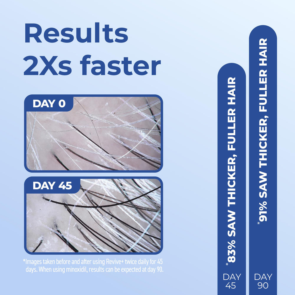 Scalp area with BosleyMD Revive+ application for even distribution