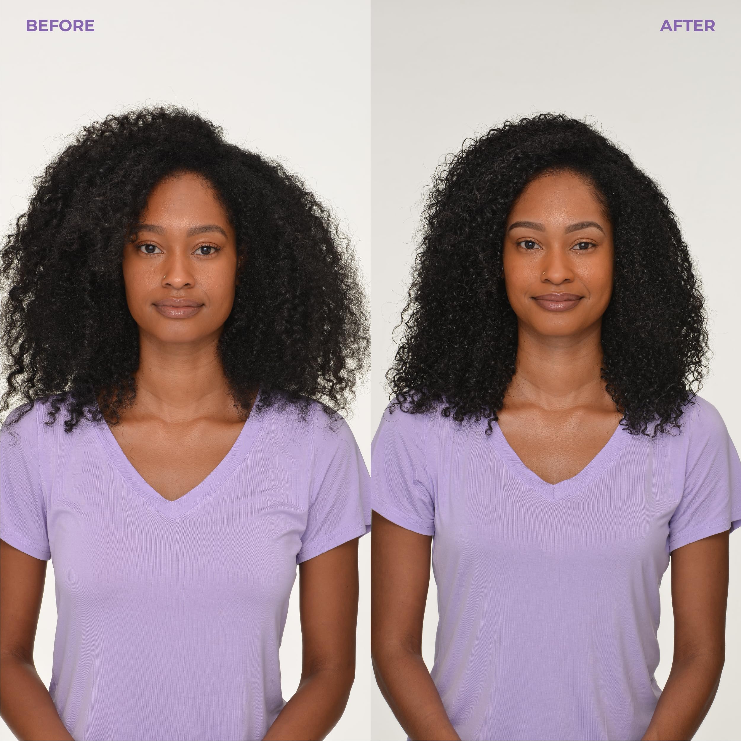 BosleyMD Saw Palmetto extract image indicating scalp defense against shedding.