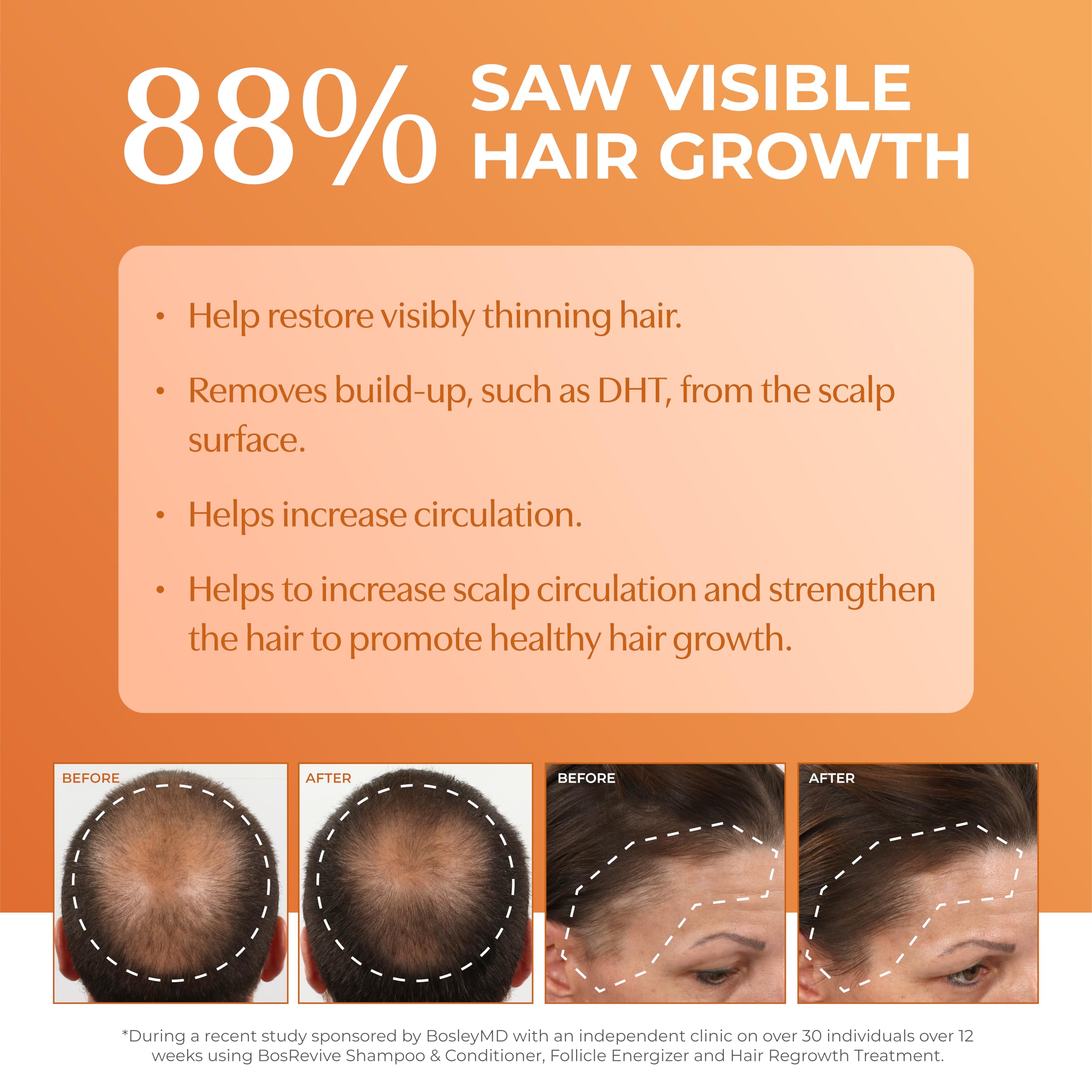 BosRevive leave-in thickening treatment dispense emphasizes a lightweight, alcohol-free formula.