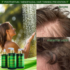Botanical Hair Growth Lab rosemary leaves and lemongrass highlight natural scalp vitality.