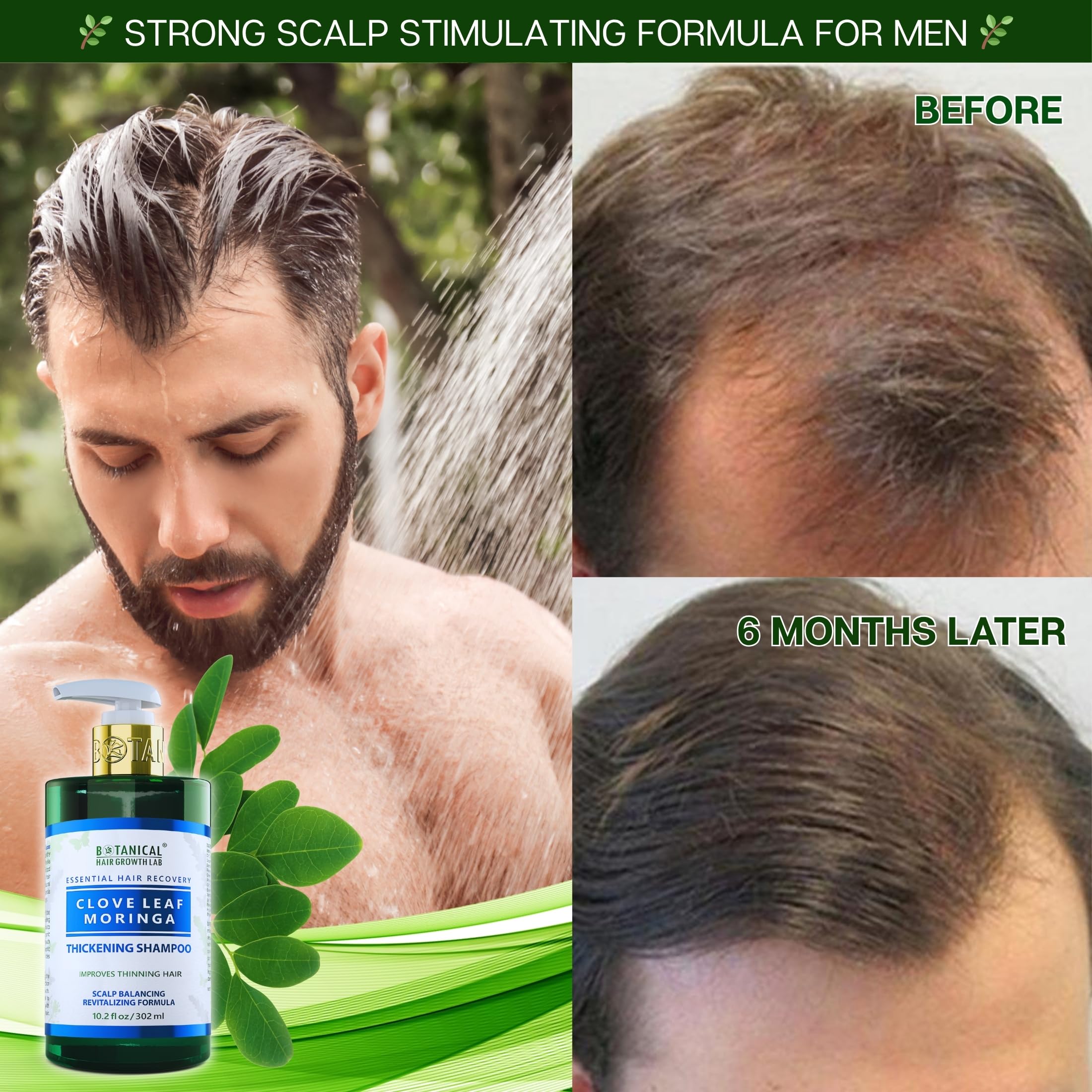 Ingredients infographic featuring Arnica, Sage, Clove and Saw Palmetto for scalp care.