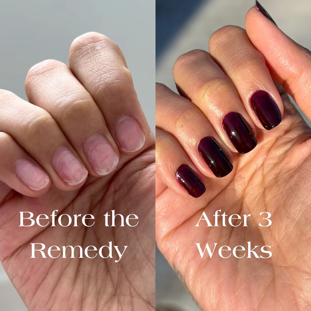 Botanist Nails The Remedy nails before after suggests improvement in appearance and strength.