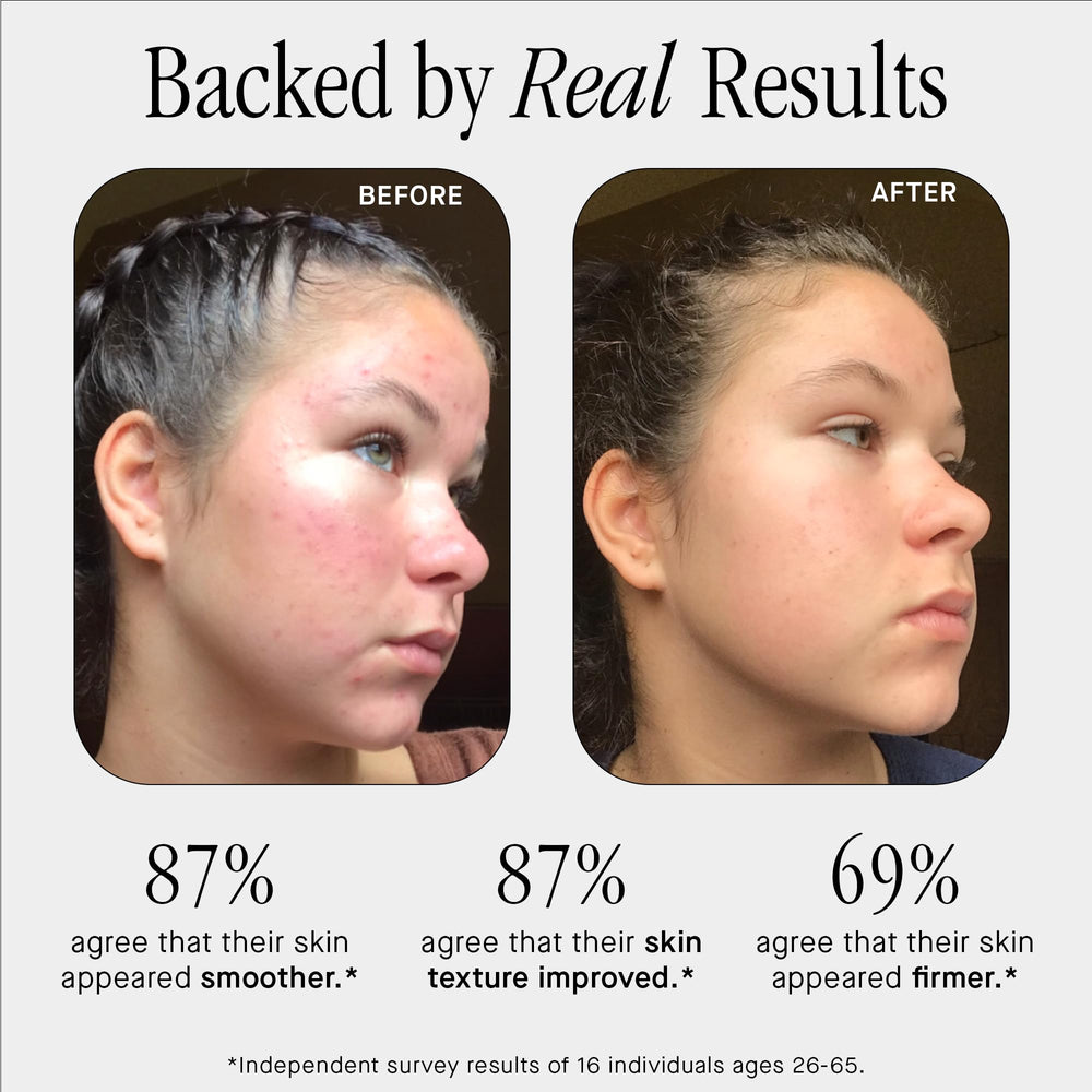 Brandefy No Needles serum label close-up highlights clean, fragrance-free formula for sensitive skin.