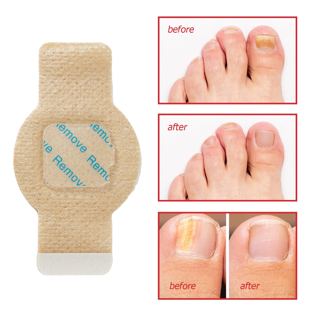 Nail Patches for toenails improve texture and thickness with use.