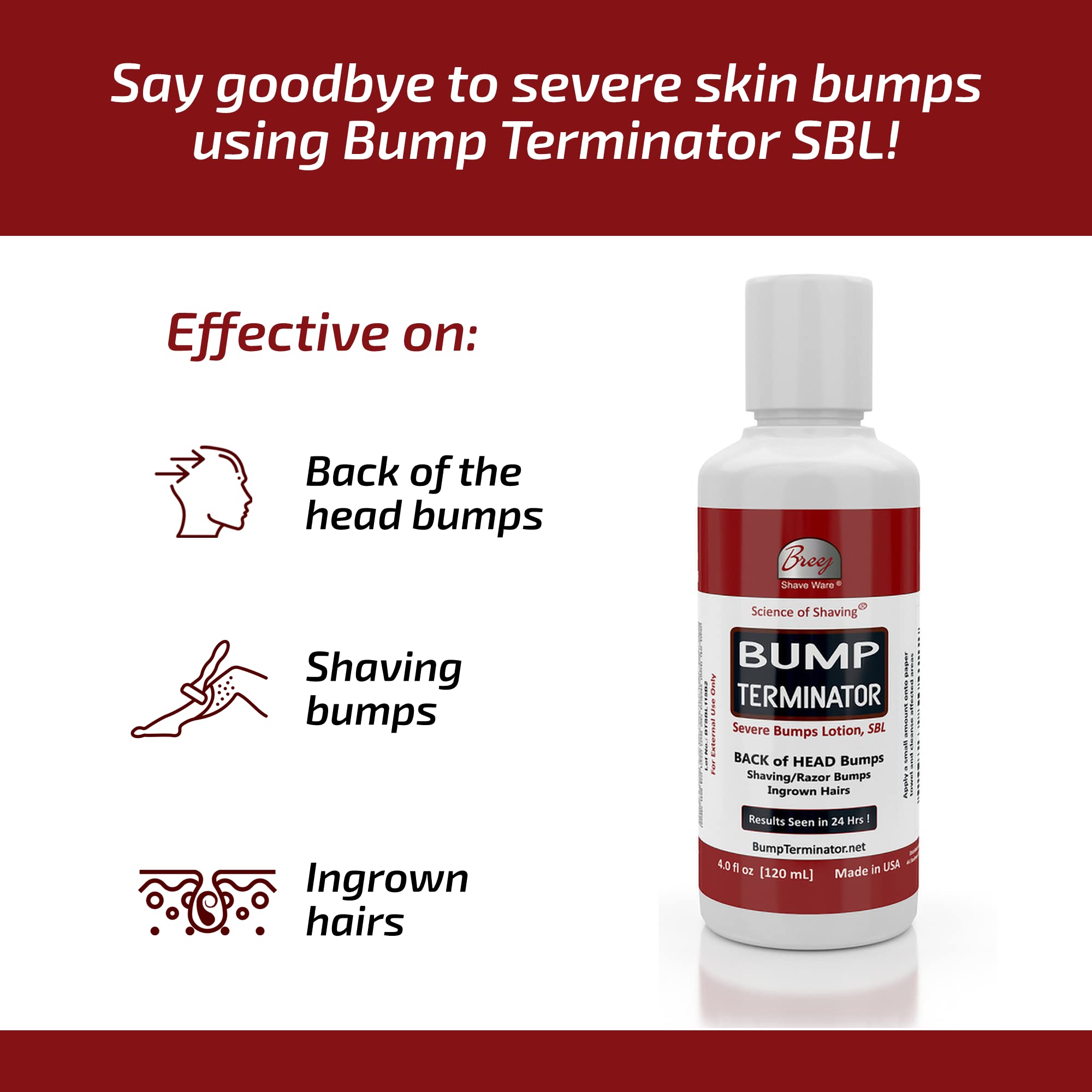 BREEJ Bump Terminator lotion on back-of-head area for soothing relief.