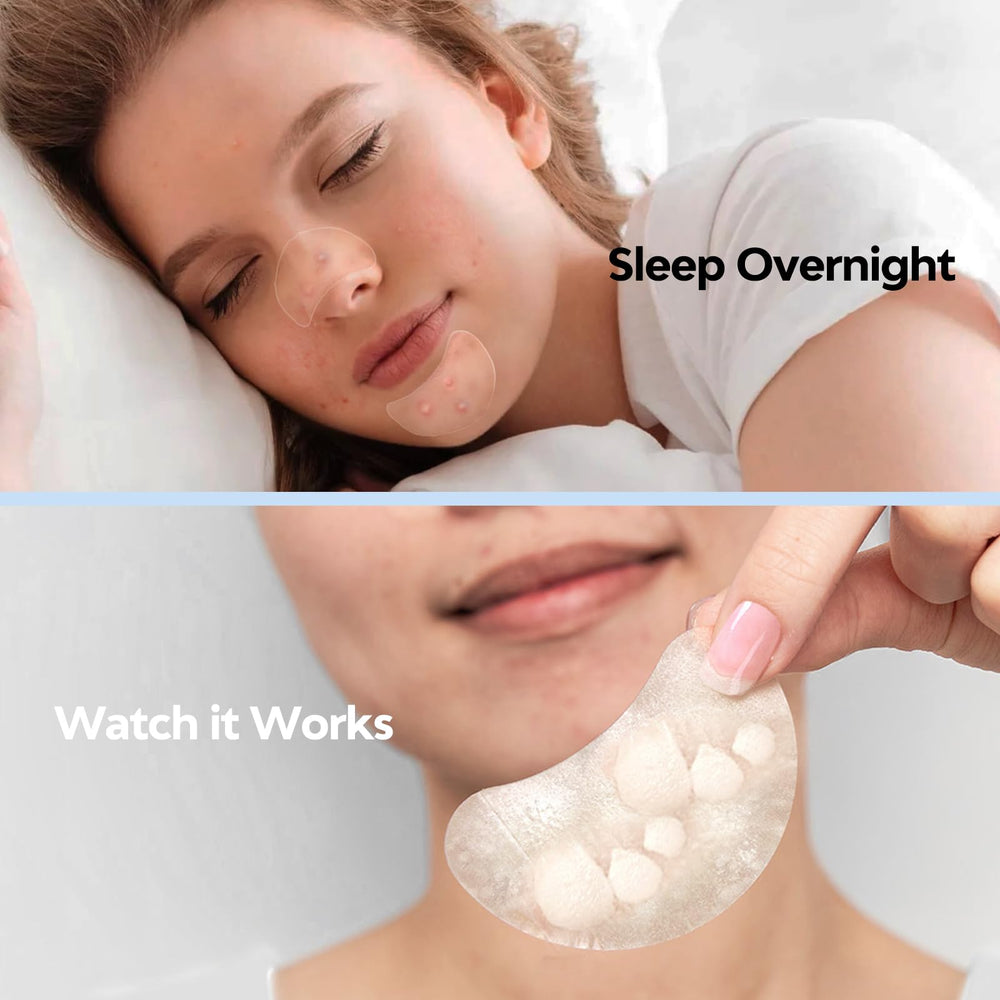 Breiboz various sizes zit patches image emphasizes targeted coverage for different pimples.