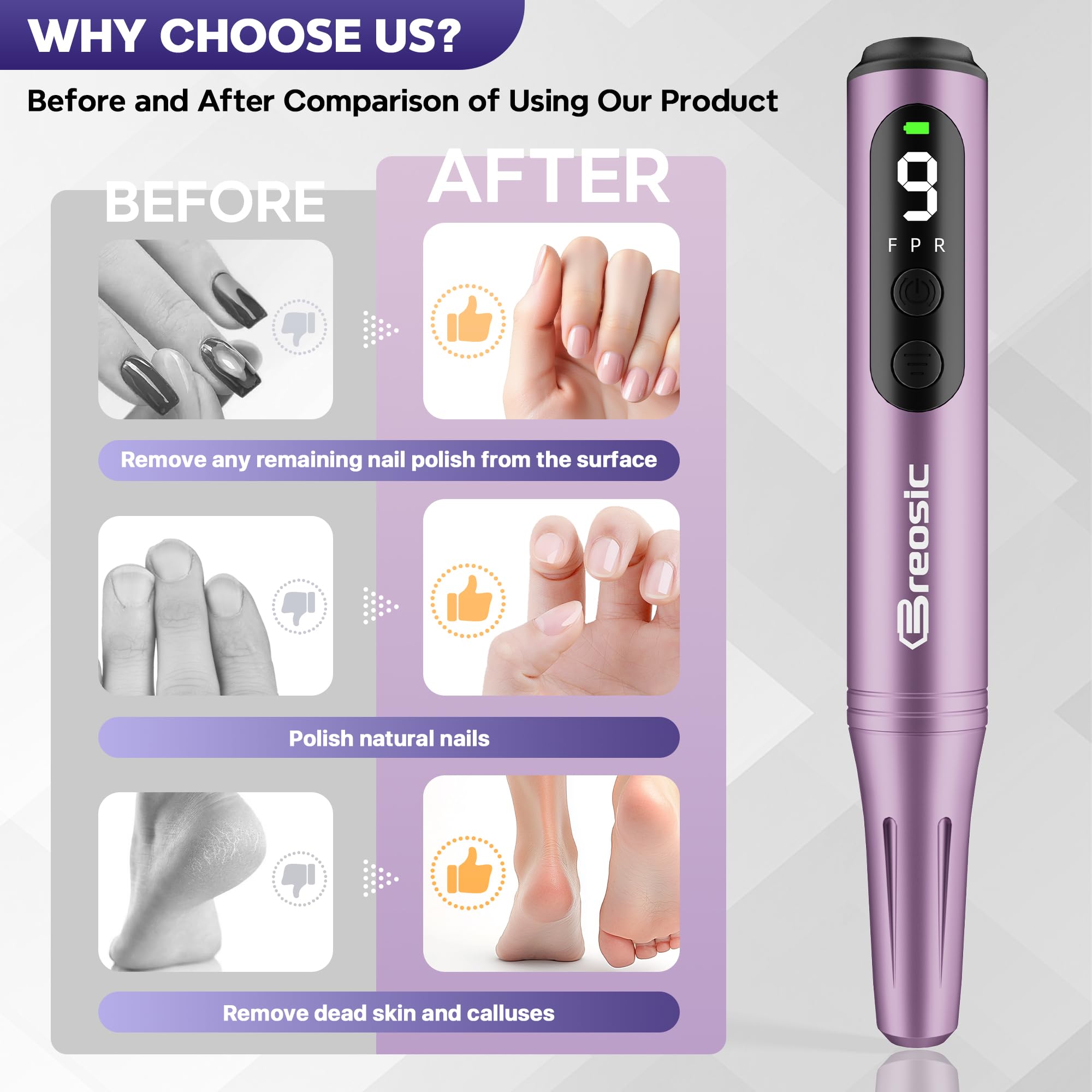 Breosic 9 speeds with forward and reverse for versatile shaping.